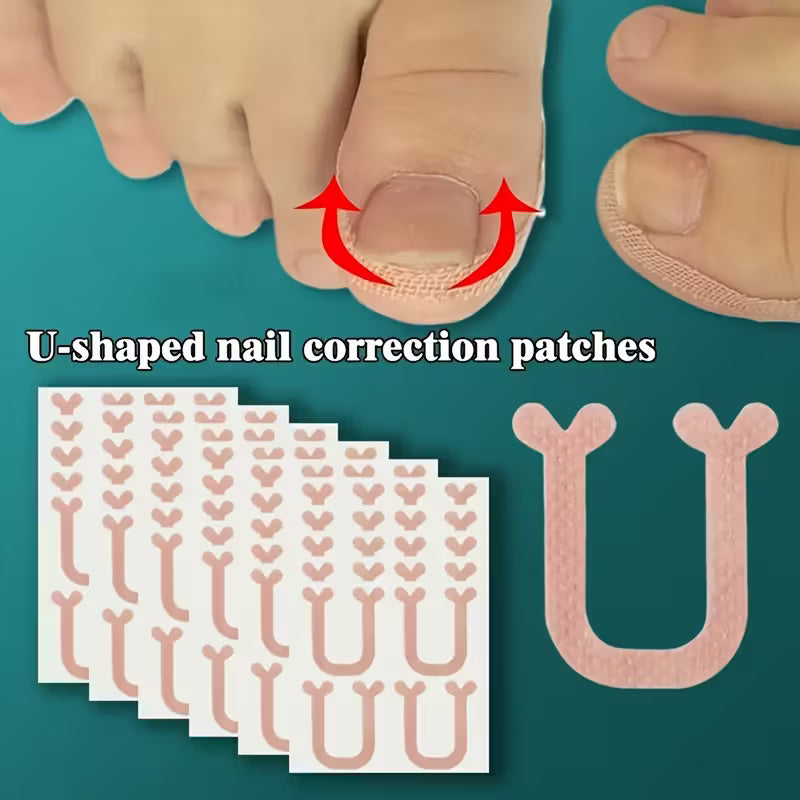 40 stk. U-formede negle plaster (indgroede negle)