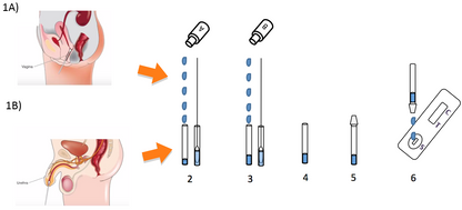 Klamydiatest til mænd og kvinder